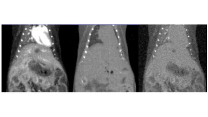 Prediction of major torso organs in low-contrast micro-CT images of mice using a two-stage deeply supervised fully convolutional network