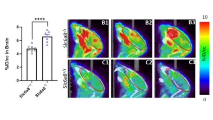 [18F]FDG-PET and [18F]MPPF-PET are brain biomarkers for the creatine transporter Slc6a8 loss of function mutation