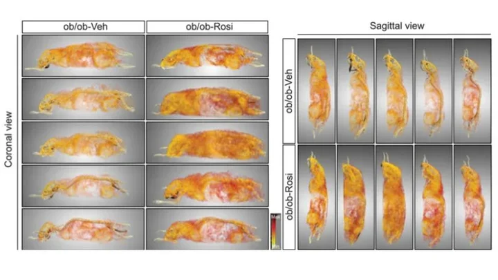 PPARγ-dependent remodeling of translational machinery in adipose progenitors is impaired in obesity