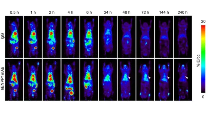 A humanized monoclonal antibody targeting an ectonucleotidase rescues cardiac metabolism and heart function after myocardial infarction