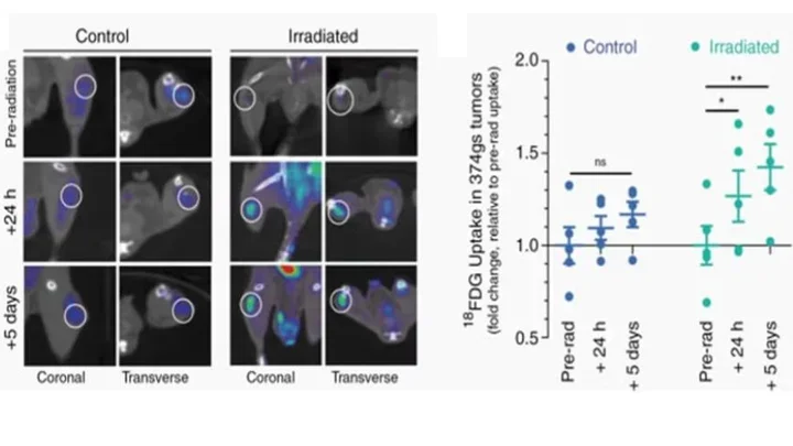 M2 isoform of pyruvate kinase rewires glucose