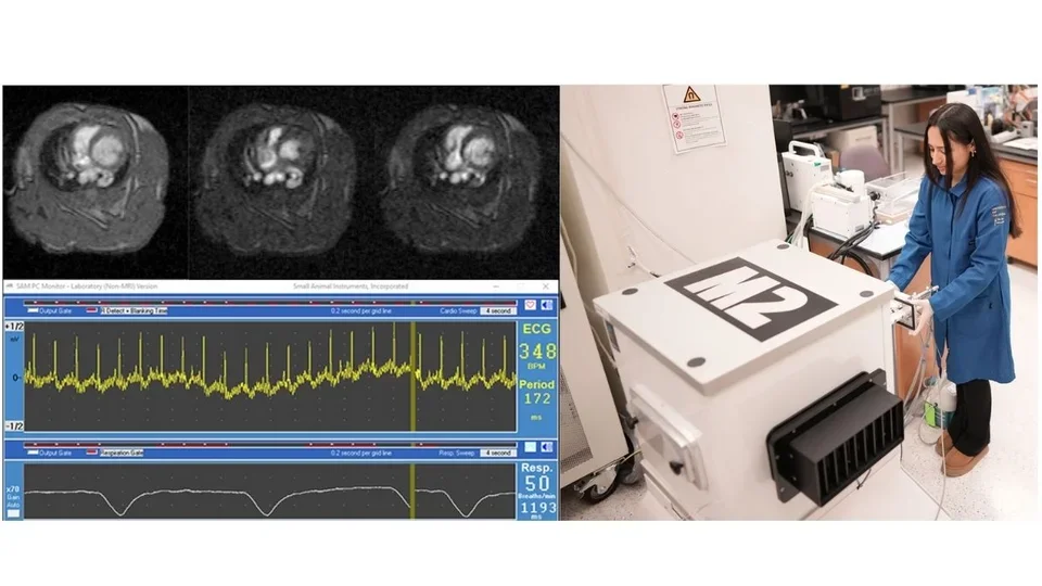 MRI