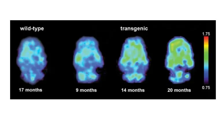 [F-18]FDDNP microPET imaging correlates with brain Aβ burden