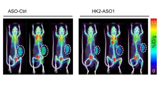 An HK2 Antisense Oligonucleotide Induces Synthetic Lethality