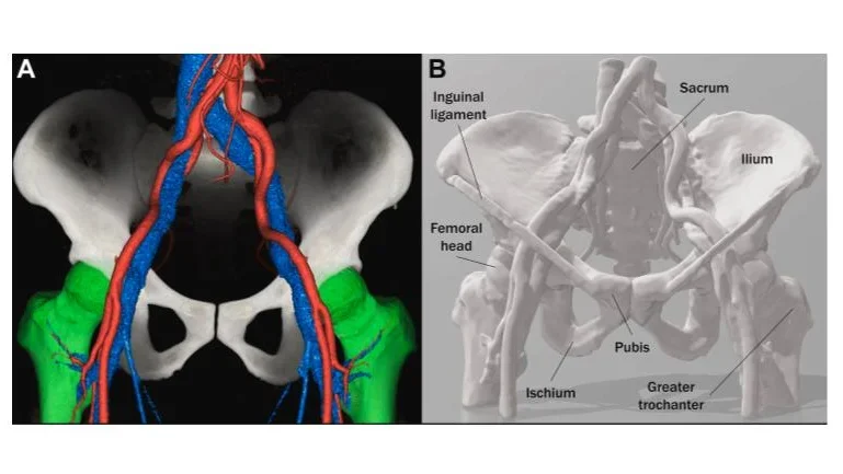 Understanding Cardiac Anatomy and Imaging to Improve Safety of Procedures: The Femoral Artery and Vein: Part 2