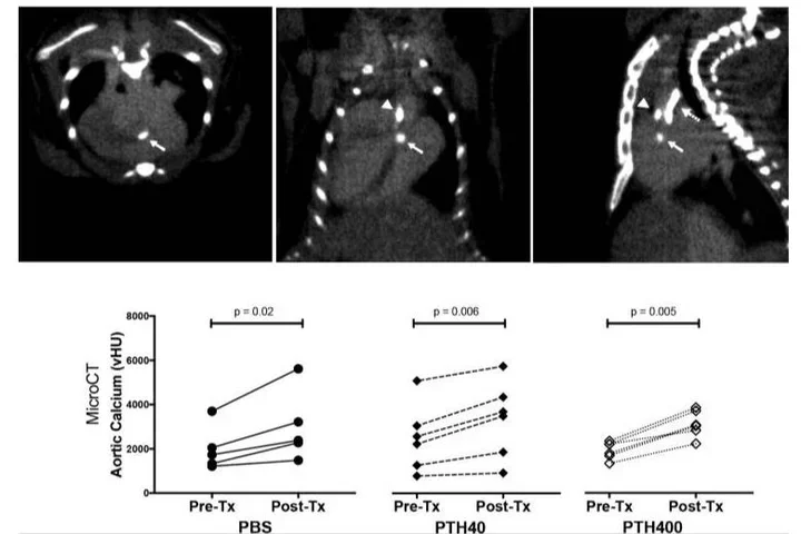Interactions between maternal fluoxetine exposure, the maternal gut microbiome and fetal neurodevelopment in mice