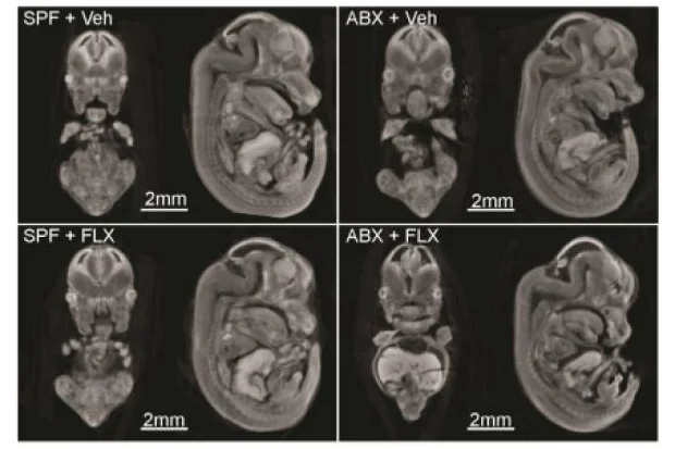 Interactions between maternal fluoxetine exposure, the maternal gut microbiome and fetal neurodevelopment in mice