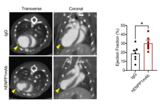 A humanized monoclonal antibody targeting an ectonucleotidase rescues cardiac metabolism and heart function after myocardial infarction