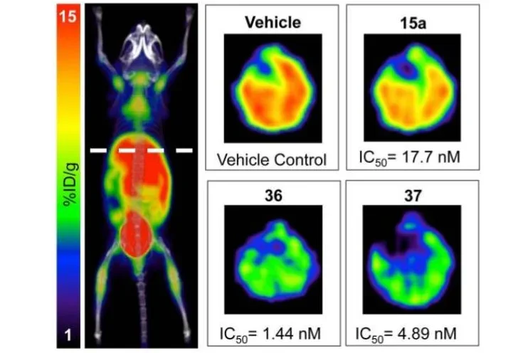 Development of new deoxycytidine kinase inhibitors