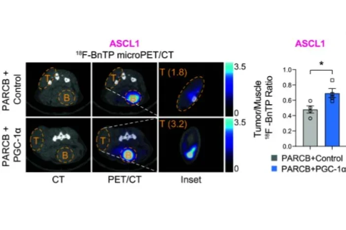 PGC-1α drives small cell neuroendocrine cancer progression toward an ASCL1-expressing subtype with increased mitochondrial capacity