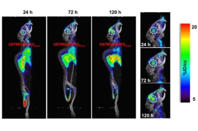 89Zr-ImmunoPET for the Specific Detection of EMP2-Positive Tumors