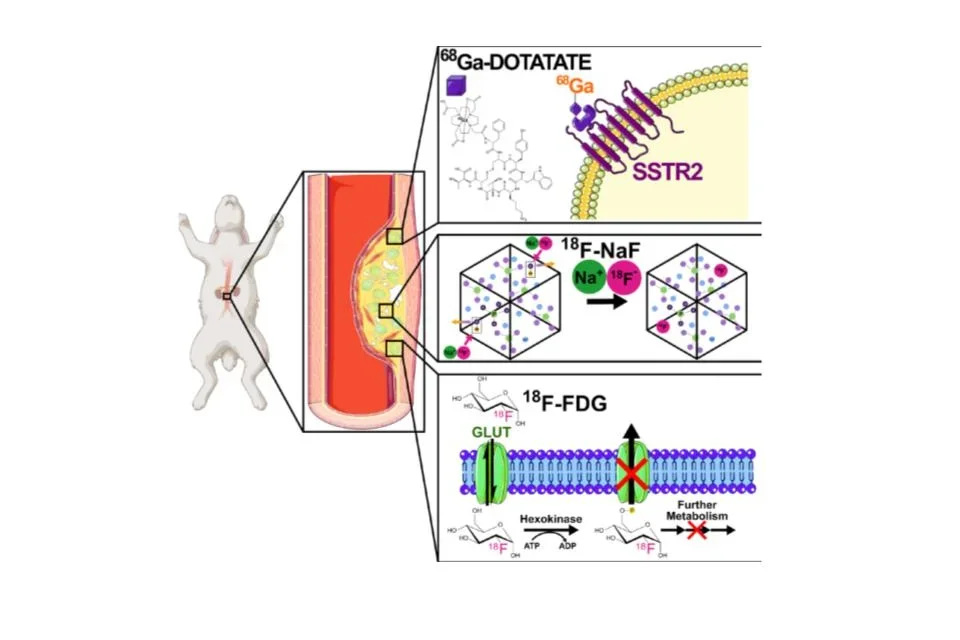 Invasive electrochemical impedance spectroscopy with phase delay for experimental atherosclerosis phenotyping