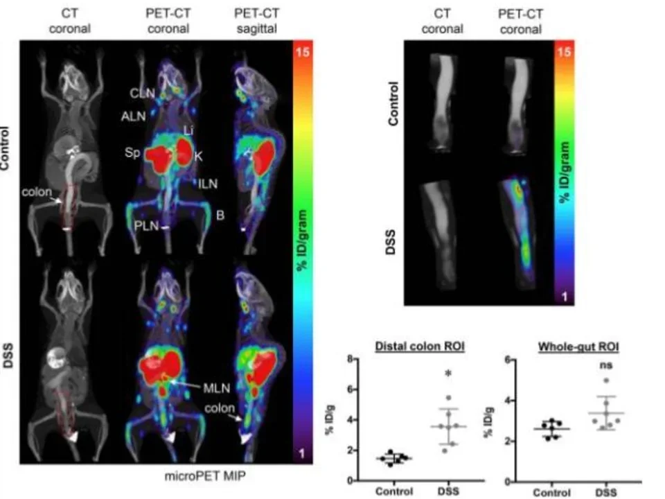 Immuno-PET in Inflammatory Bowel Disease