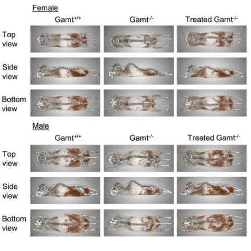Gene therapy for guanidinoacetate methyltransferase deficiency restores cerebral and myocardial creatine while resolving behavioral abnormalities
